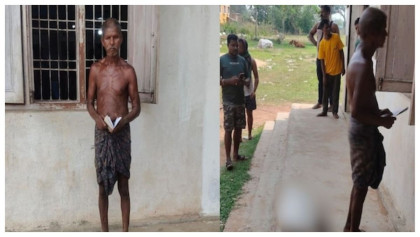 ব্যাংক থেকে টাকা তুলতে বোনের কঙ্কাল কাঁধে নিয়ে হাজির ভাই